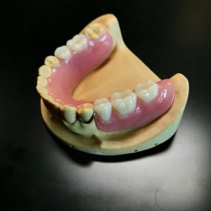 arcrylic-partial-denture--300x300.jpg  by hydentallab