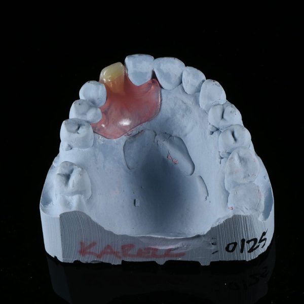 Nesbit-valplast-partial-denture-4-600x600.jpg  by hydentallab
