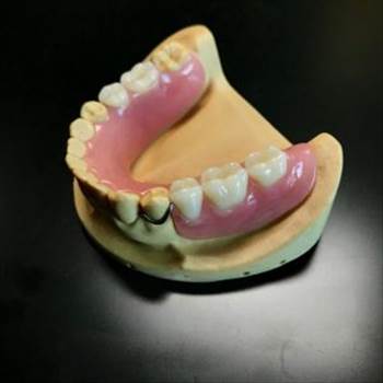 arcrylic-partial-denture--300x300.jpg by hydentallab