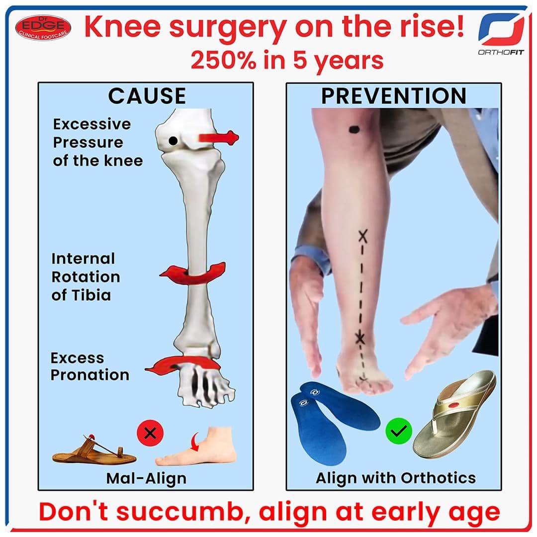 Knee surgery on the rise !.jpg  by OrthofitMart