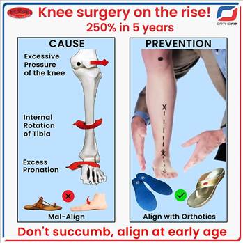 Knee surgery on the rise !.jpg - 