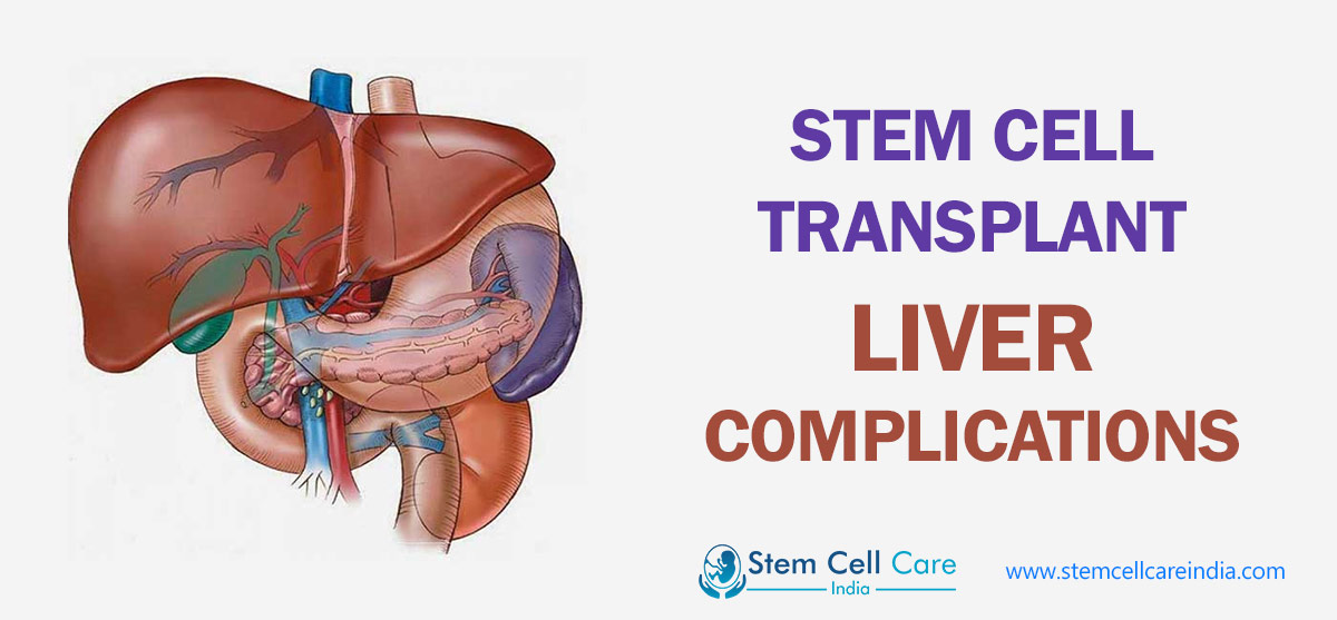 Stem Cell Transplant Liver Complications The Myriad Of Complications That Can Arise After Stem Cell Liver Treatments more info visit http://bit.ly/2nMpYwI by rohangupta