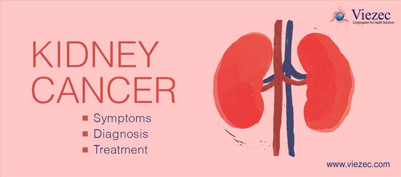 Kidney Cancer Treatment in Delhi - Viezec Provides Kidney Cancer Symptoms, Diagnosis, And Treatment More info visit http://bit.ly/2yi3RQv