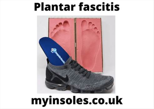 Plantar fascitis.gif by myinsoles