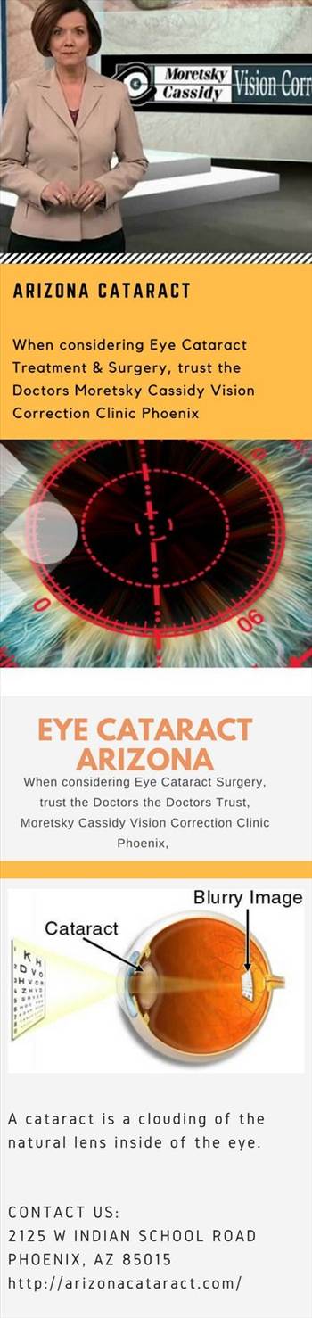 Arizona Cataract.jpeg by Arizonacataract