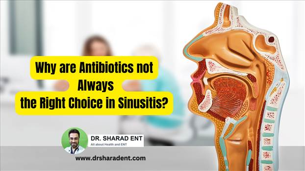 Got a stuffy nose and wondering whether you should pop an antibiotic pill to get rid of sinusitis? Hold on a minute! Did you know that antibiotics may not always be the best choice for treating sinusitis? Let's find out why together!

Visit- https://www