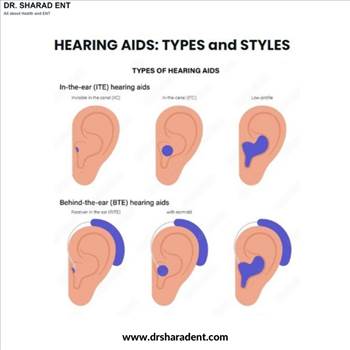 On the search for the best hearing aid? Searching for the right type and style for you depends on the level of hearing loss.
Two basic types of hearing aids:

In-the-ear (ITE) hearing aids
Behind-the-ear (BTE) hearing aids
https://bit.ly/3adxwAu