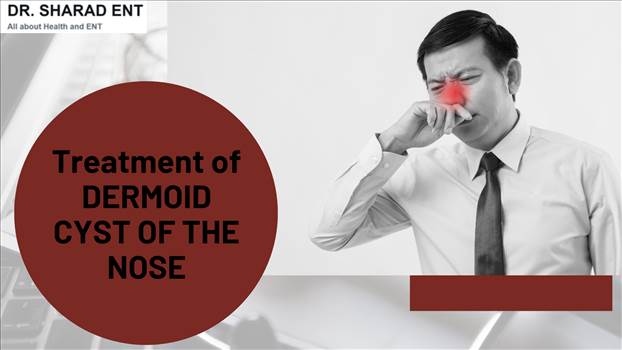 Treatment of DERMOID CYST OF THE NOSE.png - 