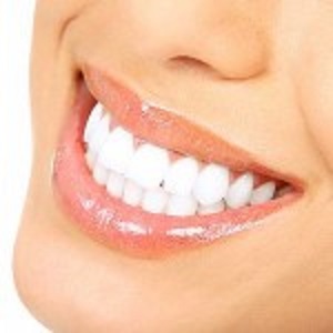 Porcelain Veneers Waco Enhance your smile quality, contact dentists at Waco Family Dentistry who are experienced to provide complete treatment for any problem caused by decay or periodontal disease. https://wacofamilydentistry.net/ by Waco Family Dentistry