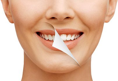 Dentists In Waco TX Teeth whitening is one of the demanding cosmetic procedure, and at Waco Family Dentistry the goal of dentist is to meet the dental health needs of customers. https://wacofamilydentistry.net/ by Waco Family Dentistry