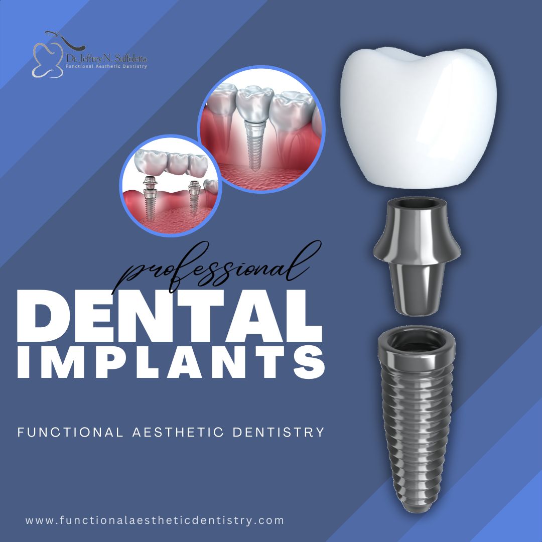 Dental Implants a Paradigm Shifts in Modern Dentistry Visit : https://www.functionalaestheticdentistry.com/dental-implants/
 by FAdentistry01