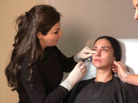 Dr. Malda has extensive experience in aesthetic dermatology with special interest in Botox, dermal fillers. Visit the Skin care best dermatologist clinic in Dubai.

See more :- https://drmalda.com/