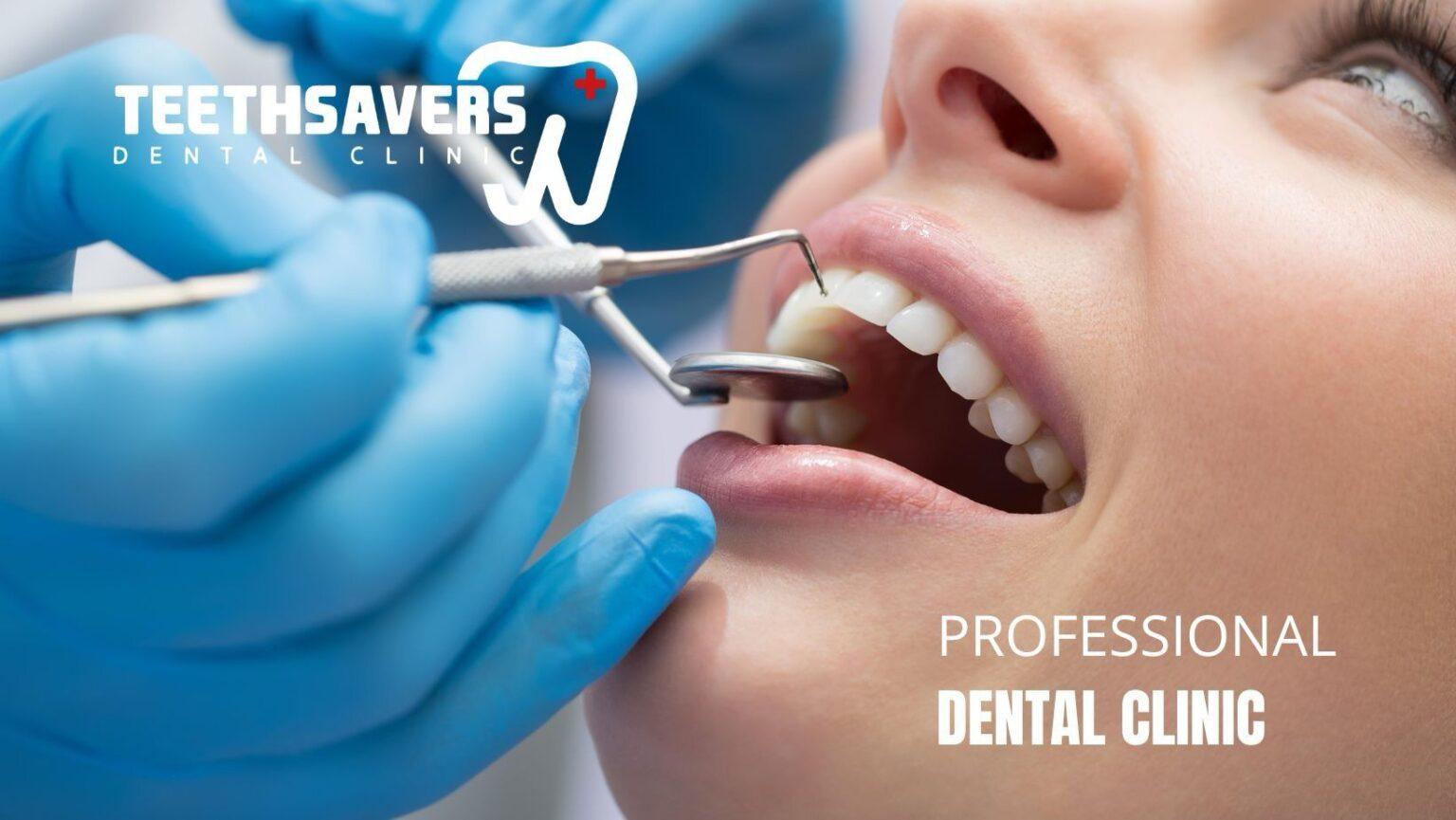 llll.jpg  by teethsaversdentalclinic