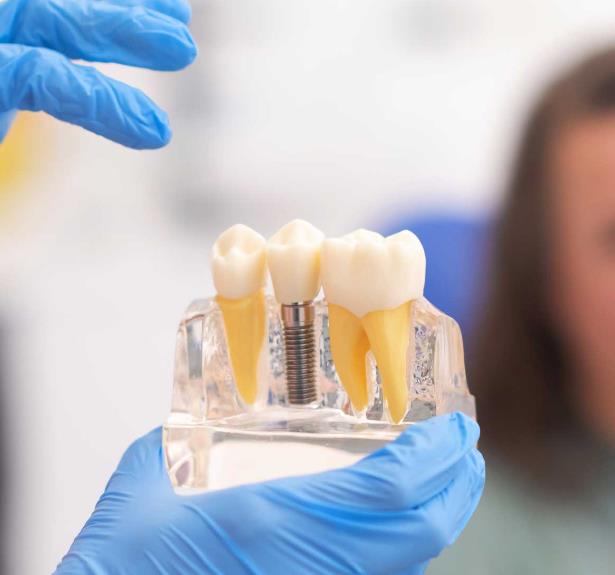 gg.jpg  by teethsaversdentalclinic