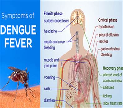 Symptoms-of-Dengue.jpg by alwayspharma111
