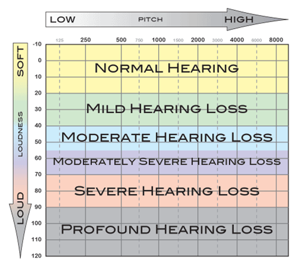 Audiogram.png  by JohnBunker