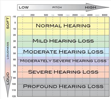 Audiogram.png by JohnBunker