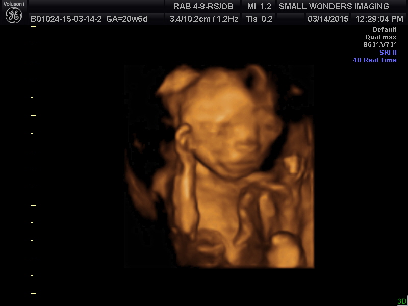 Rhodes 3d (2)  by EricaLy