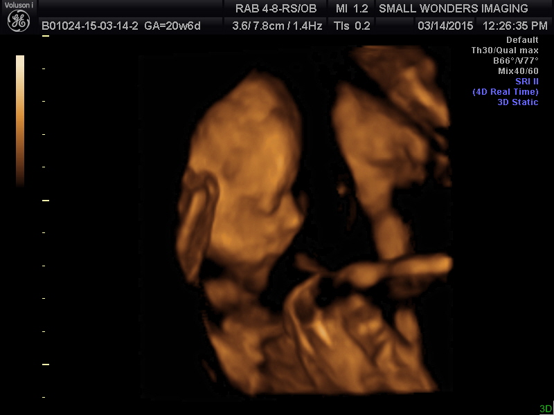 Rhodes 3d  by EricaLy