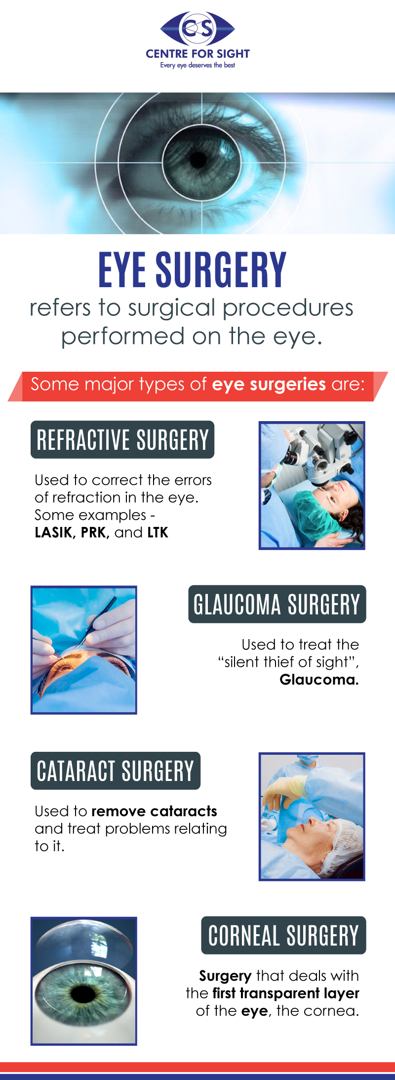 Eye Surgery Eye surgery refers to surgical procedures performed on the eye. Some major types of eye surgeries at right here.
 by centreforsight