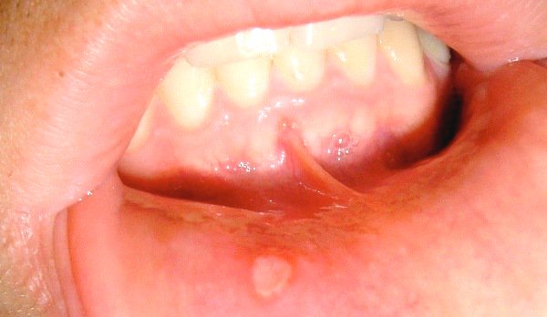 05.jpg  by indiadentalworld