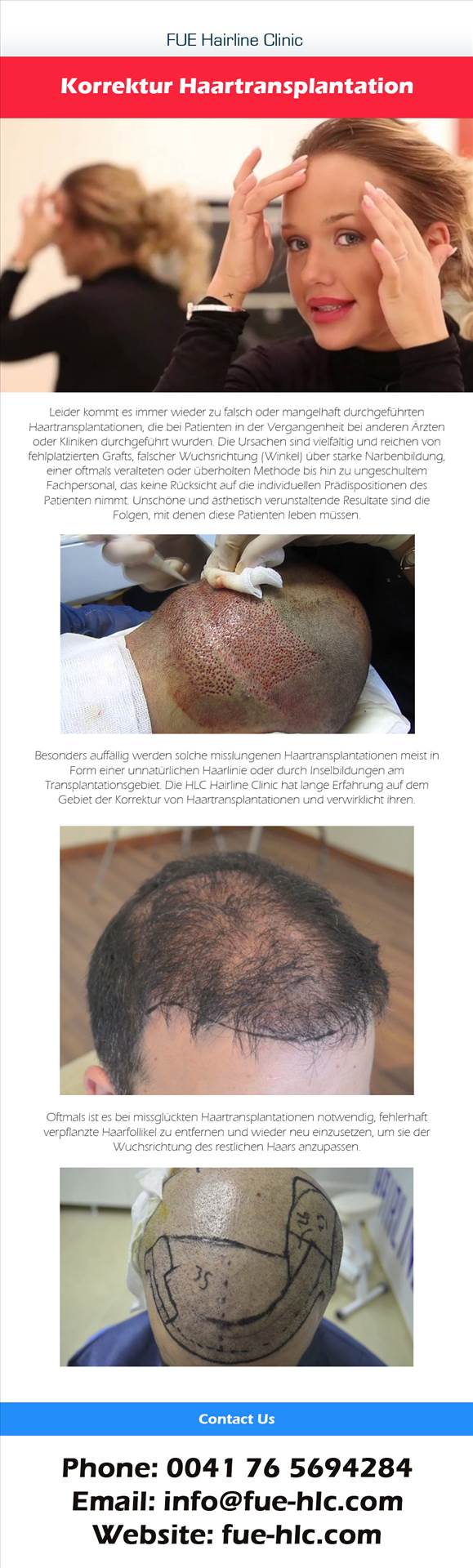 Hair Transplant Ankara.jpg  by FueHlc