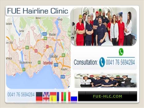FUE Hairline Clinic.JPG - 