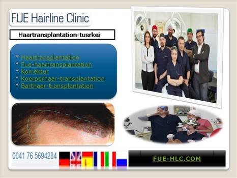 Fue Hair Transplant Turkey.JPG by FueHlc