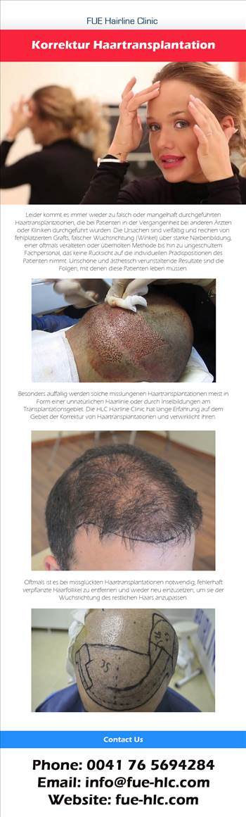 Hair Transplant Ankara.jpg - 